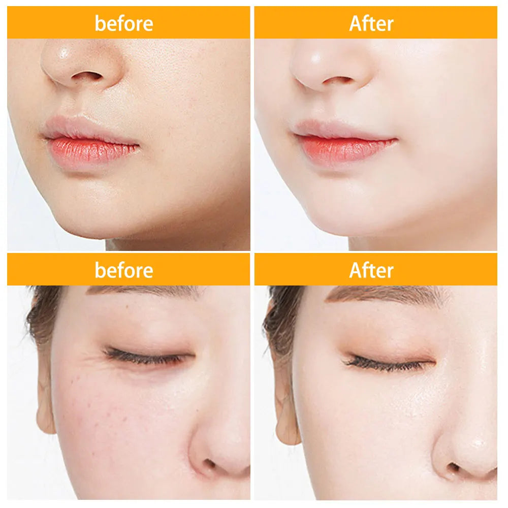 30pcs Hyaluronic Acid Capsules Hydrating, Repairing Facial Essence